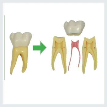 1 Padidinti Dantų Patologija Modelis, naudojant mokymo ir aiškiai matyti