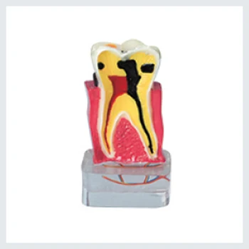 1 Padidinti Dantų Patologija Modelis, naudojant mokymo ir aiškiai matyti