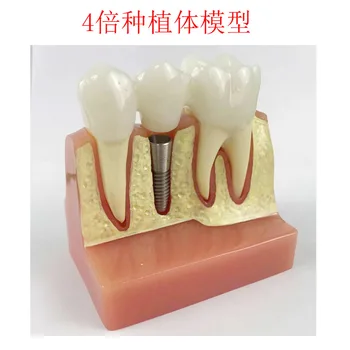4X Kartus Burnos, Dantų Modelio Žmogaus Dantų Anatomijos Modelis Medicinos Mokymo Reikmenys Stomatologas Mokymo priemones Dantų Implantai Modelis